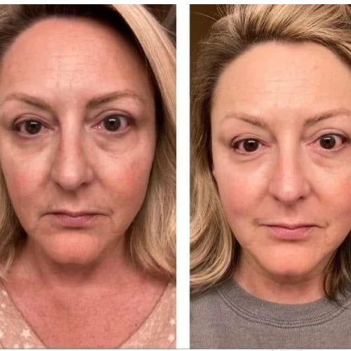 3x WeGlow Mask Collagen-Boosting Night Mask | Visibly younger skin in just 7 days!