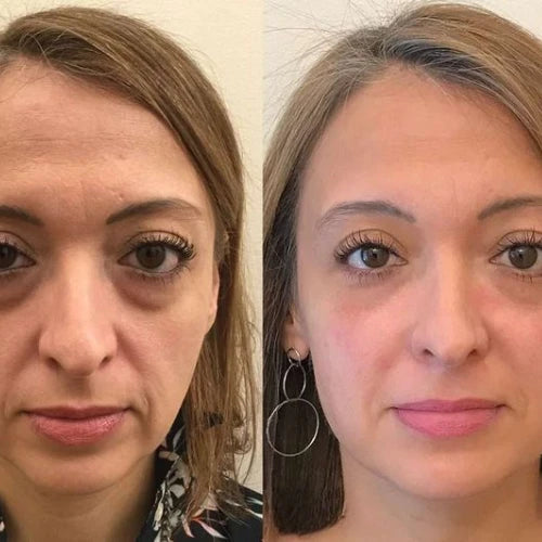 3x WeGlow Mask Collagen-Boosting Night Mask | Visibly younger skin in just 7 days!