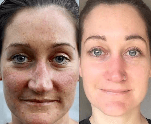 Lumiéra Mask Collagen-Boosting Night Mask | Visibly younger skin in just 7 days!