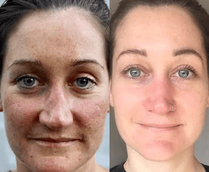 Lumiéra Mask Collagen-Boosting Night Mask | Visibly younger skin in just 7 days!